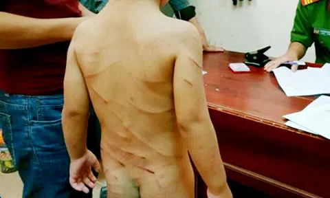 Lời khai của người cha dượng đánh con riêng của vợ chi chít vết thương